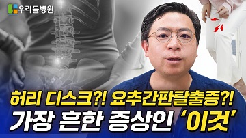 허리디스크 증상에서 가장 흔한 이것!