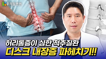 허리에 통증이 많이 발생하는 디스크 내장증