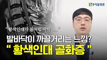 황색인대 골화증 알아보기!